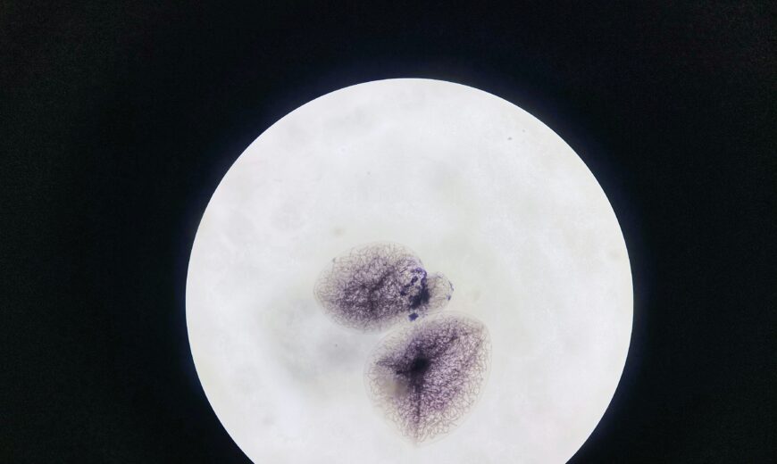 Embryo Transfer Be parent